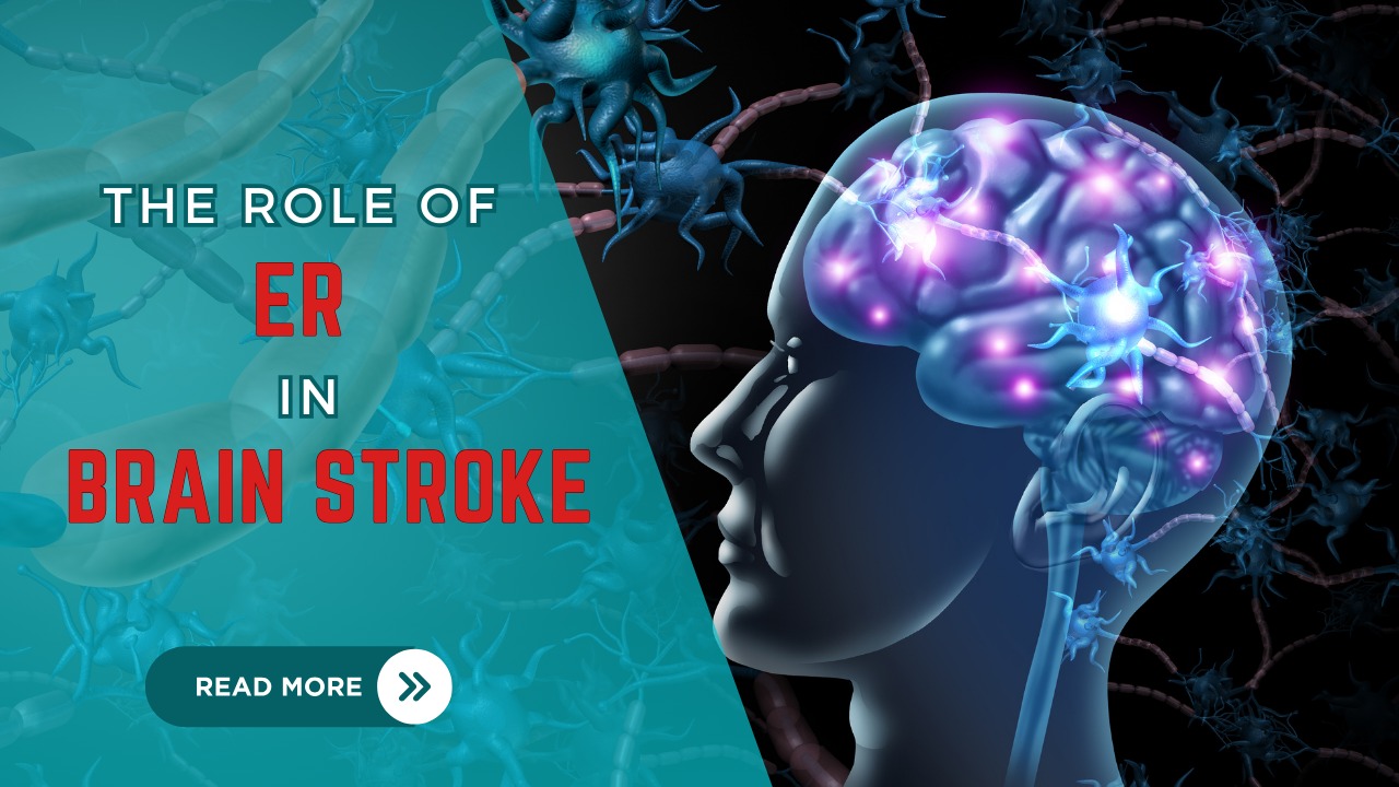 Brain Stoke: The Role of ER in Brain Stoke