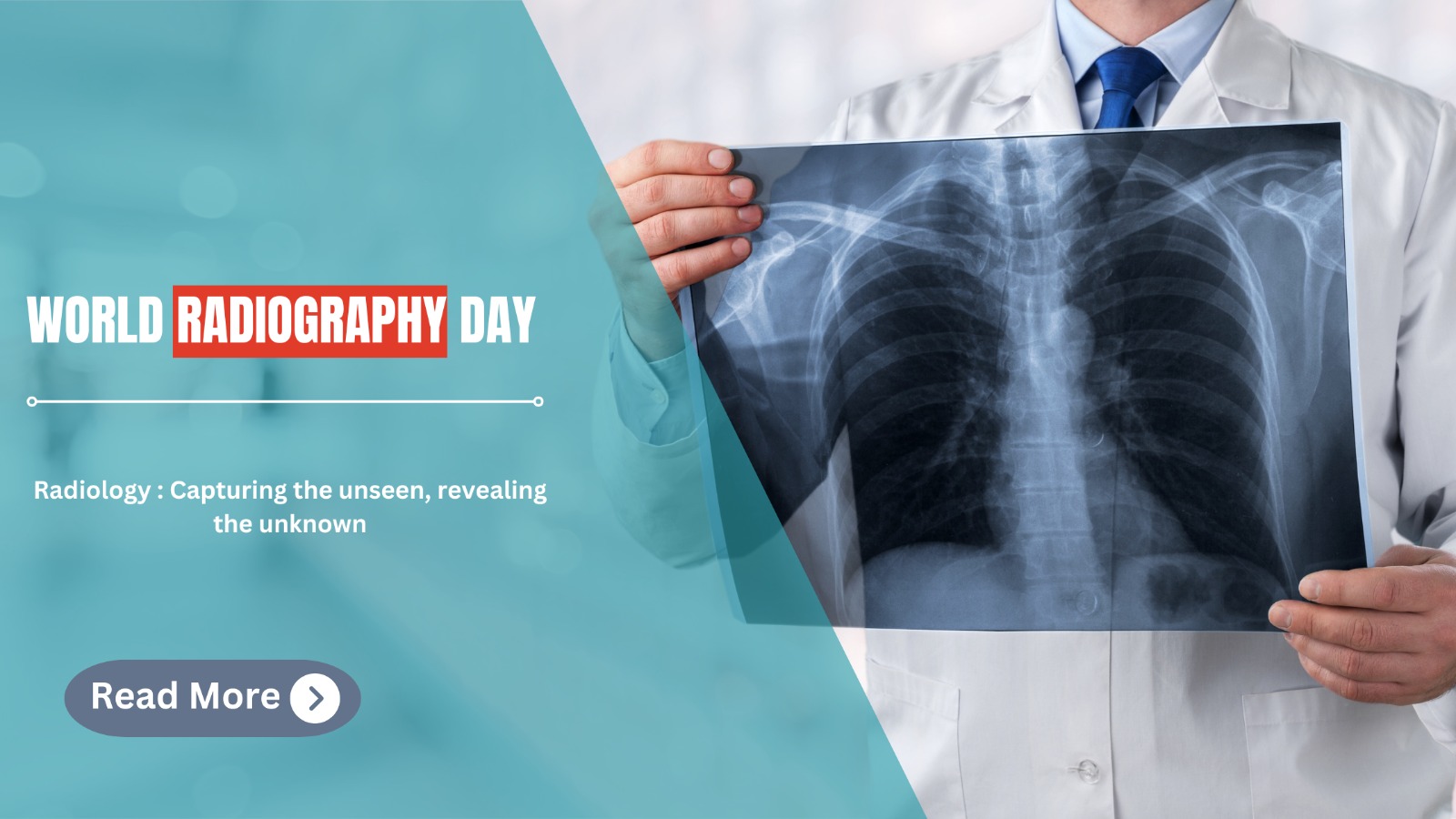 World Radiography Day: Honoring the Power of Medical Imaging