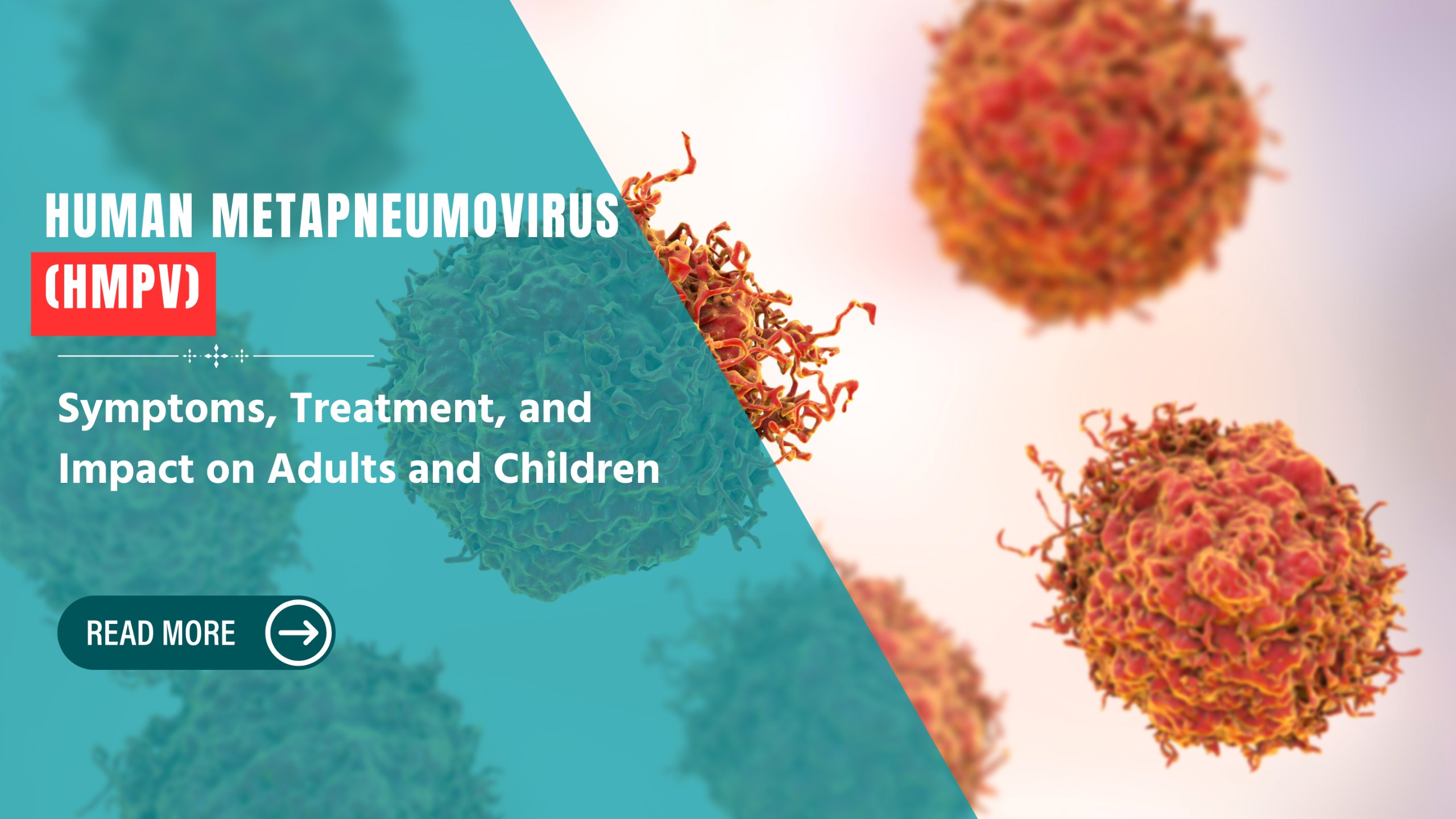 Human Metapneumovirus (HMPV): Symptoms, Treatment, and Impact on Adults and Children